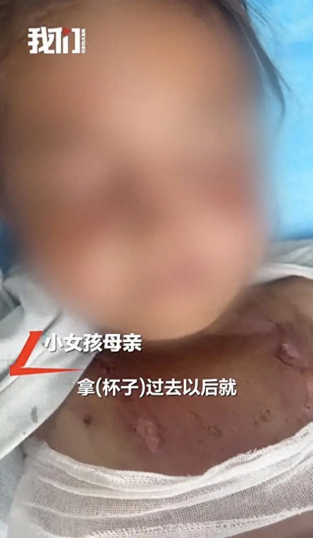 广东6岁女童被高年级同学泼开水烫伤 事发后已经报警